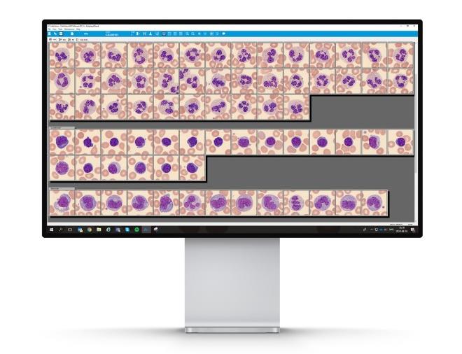 Computer screen with cell morphology system